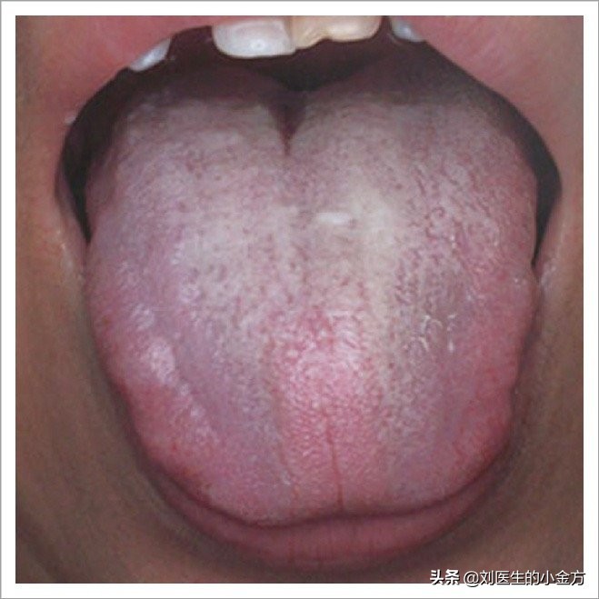 《中医舌诊》,9大体质舌诊图,看看你属于哪种?