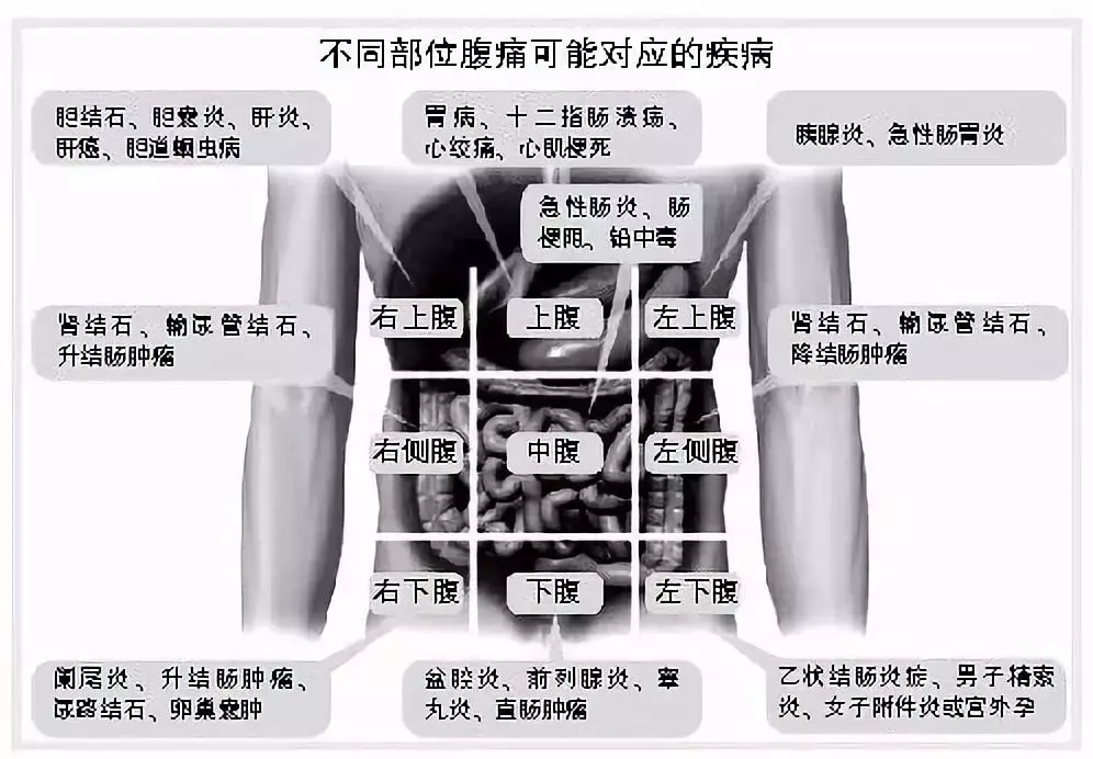 女性小腹右下侧疼痛的原因分析