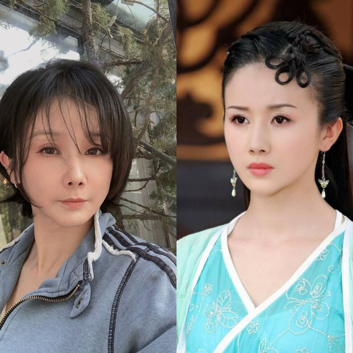 盘点10大整容失败的女星:假体乱飞,前途葬送