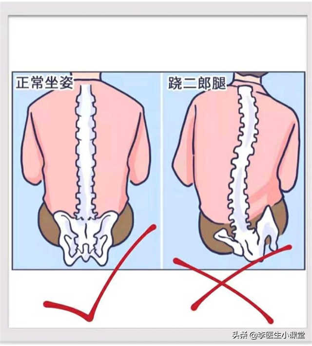 膨出和突出有区别吗图片