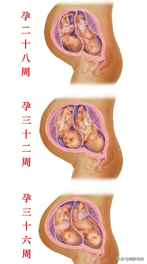 古代孪生子少是有原因的！了解双胞胎出生前的发育历程，太神奇了