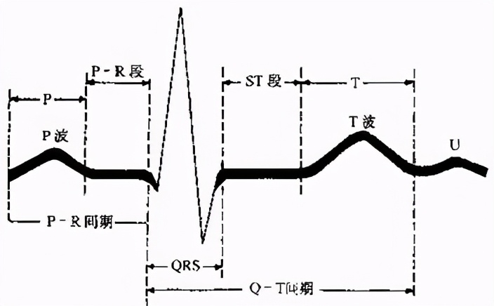 掌握常见心电图我的心脏我做主