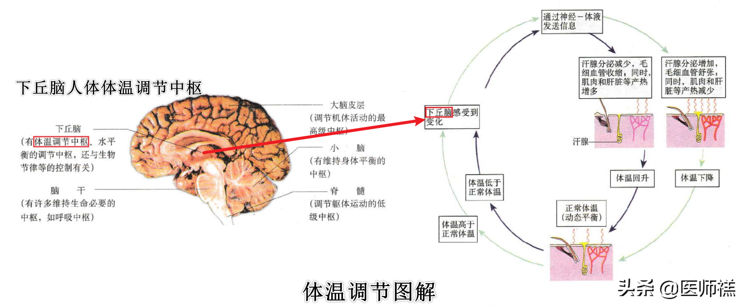 发烧头疼快速缓解方法：物理降温 vs 捂汗退烧哪个更有效？