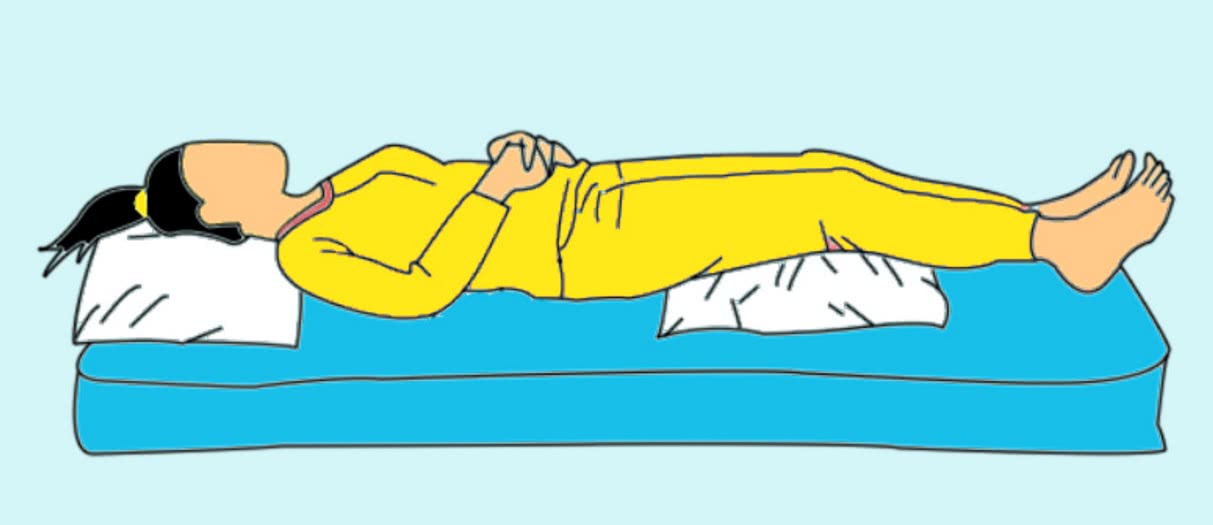 腰间盘突出什么睡姿最好图解(腰椎间盘突出,你睡对了吗?