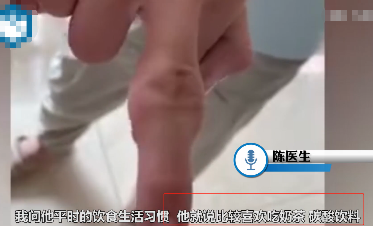 14岁男孩手指肿胀变形，只因长期喝奶茶饮料，折射出留守儿童之殇