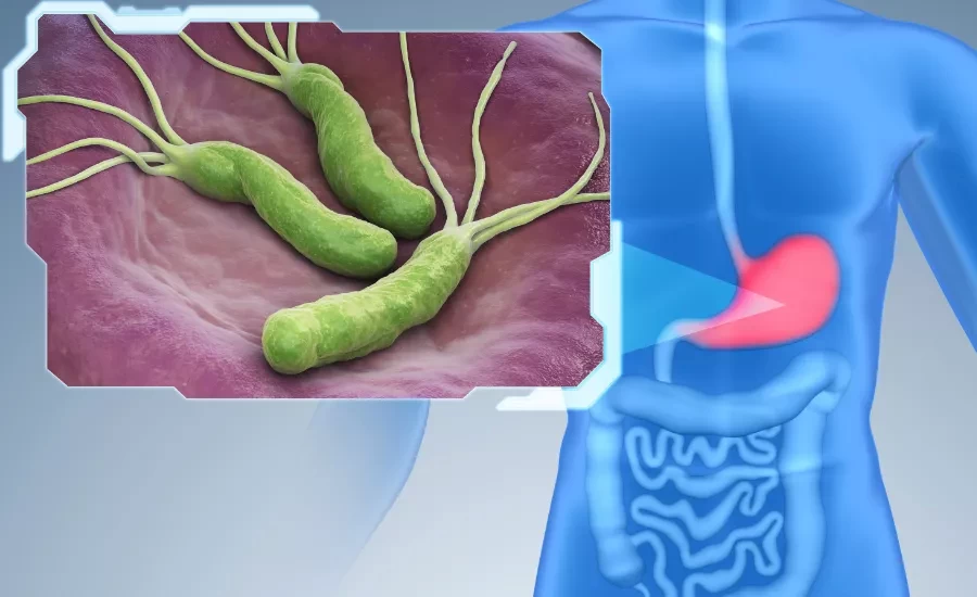 最养胃的“运动疗法”,你知道吗?(附10种健脾养胃的食物)