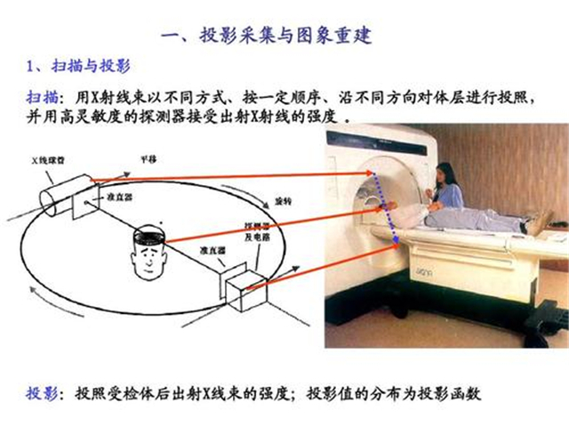 做肝脏检查，选CT还是选B超？哪个结果更精确？