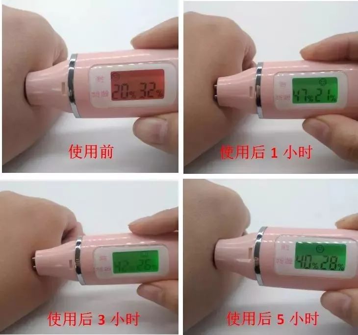 寒冬来了，身上又起皮干燥？戚薇教你一妙招，只需抹一下就好