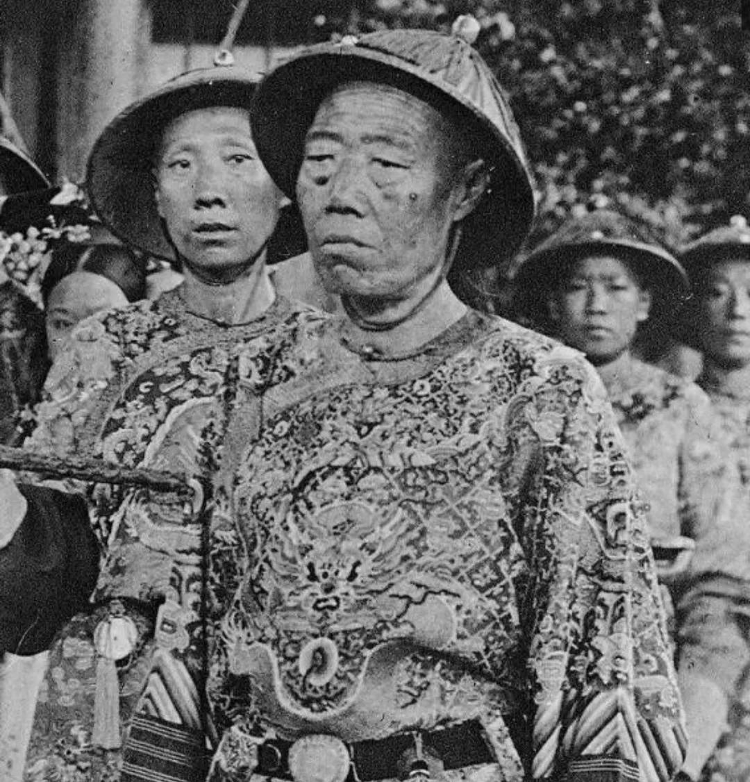 宫刑具体割哪个部位？割完以后还要挂在房梁上放几十年