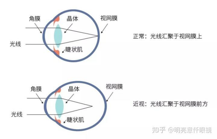 老花眼是如何配镜的，家有老人的你们都了解吗？