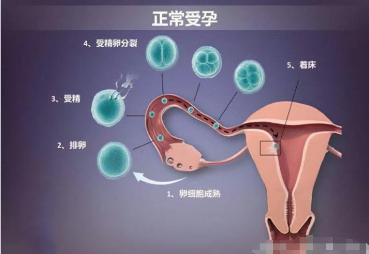 女性为什么容易长子宫肌瘤？医生提醒：这3个因素要注意