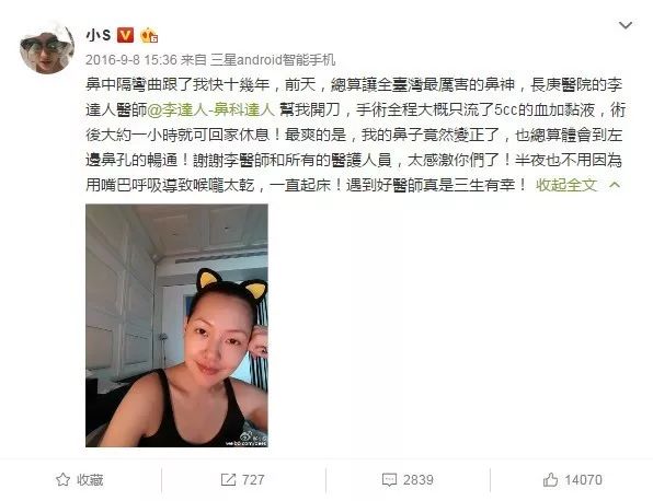 小S做的这个小手术，听说能治好鼻炎！靠谱吗？