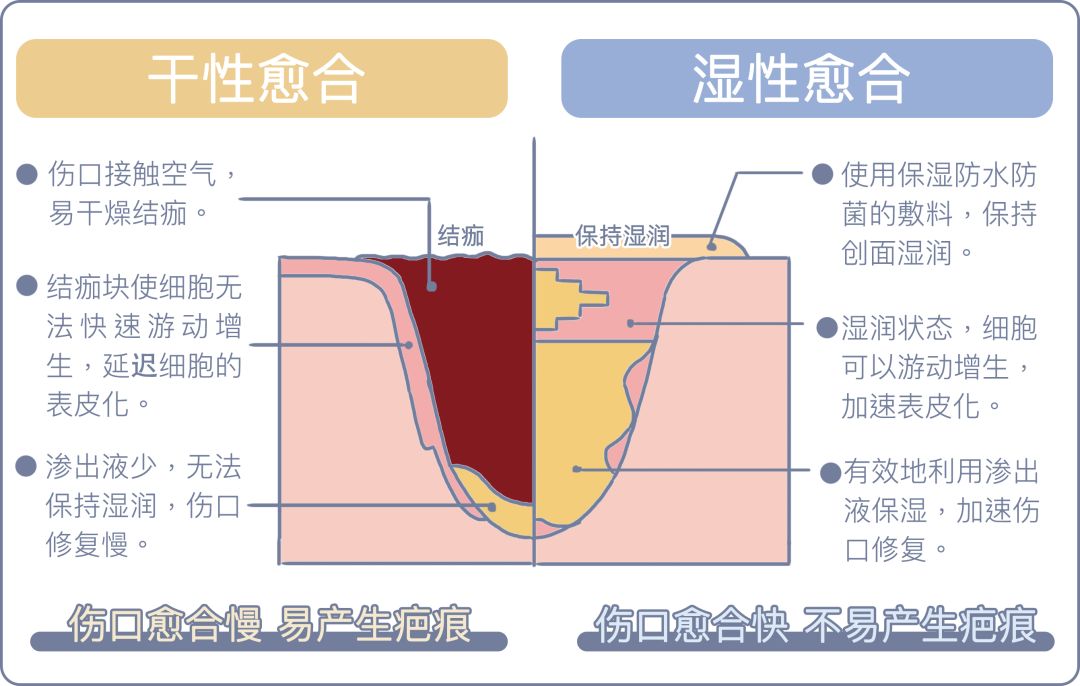 伤口结痂反而愈合慢,你知道吗?