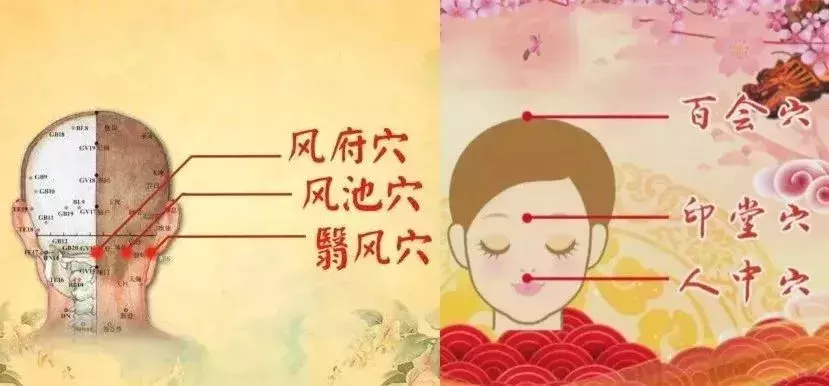 头痛也是疾病信号：5种类型的头痛，都“各有所属”