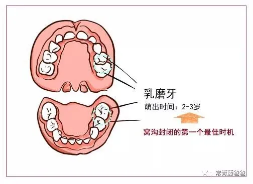 6-12岁换牙时间和换牙期问题大盘点!孩子一口好牙关键就在这几点