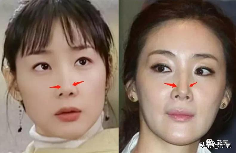 韩国悲剧女王崔智友,明明大眼睛水汪汪,但是整体长相却很悲情?