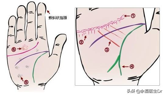 24种手诊图，揭示你的身心健康