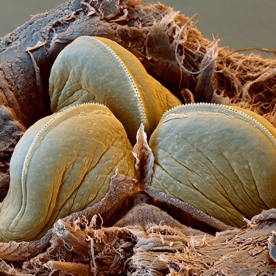 蚂蝗是什么，蚂蟥会在人体内长期存活吗？