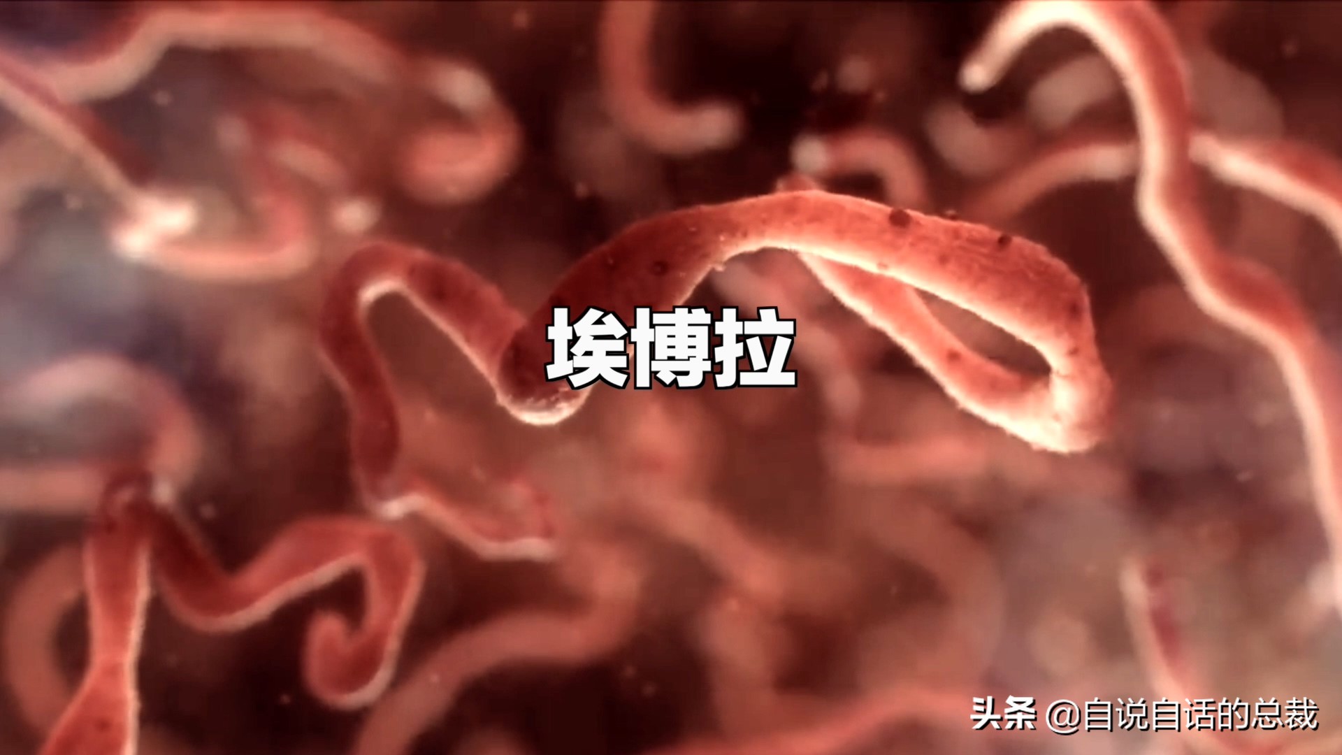 埃博拉：人类的诅咒，你的身体如何对抗它，它到底有多恐怖