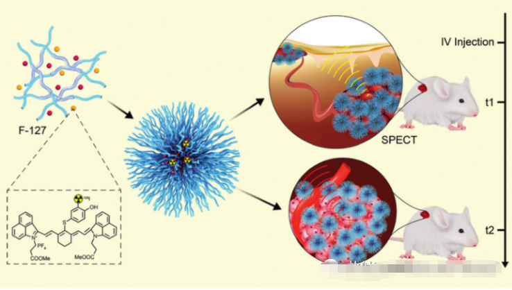 重磅！我国一年新增约457万人患这种病，苏州大学科研成果在线发表！