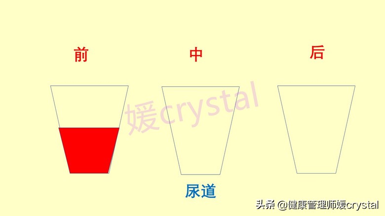 孩子尿液白色有沉淀，是不是健康有问题？4个方法判别