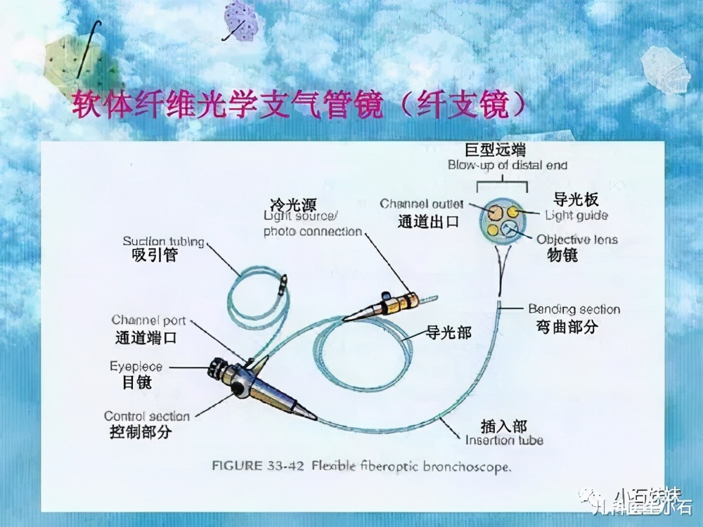 纤维支气管镜你了解多少