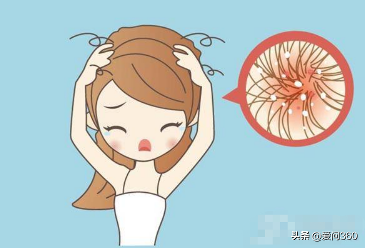 头皮上小疙瘩不断？原因令人错愕，早知道早解决
