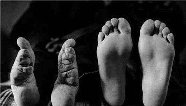 畸形审美：浅谈“裹小脚”的起源、发展与盛行