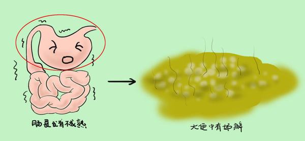 医生：新生儿便便有规律，认识这11种便便，判断宝宝健康很轻松