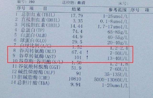 谷丙转氨酶偏低图片