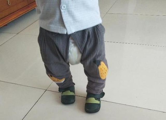 ▼ 新生儿时期不要绑腿新生儿时期不必绑腿,强制把腿绑上会影响婴儿的