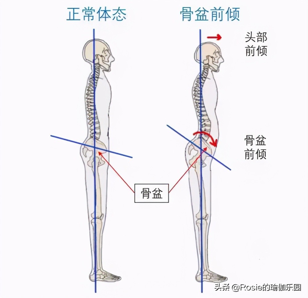 跳绳、跳操水桶腰、大肚子甩不掉？每天坚持这3步，轻松缩腰瘦腹