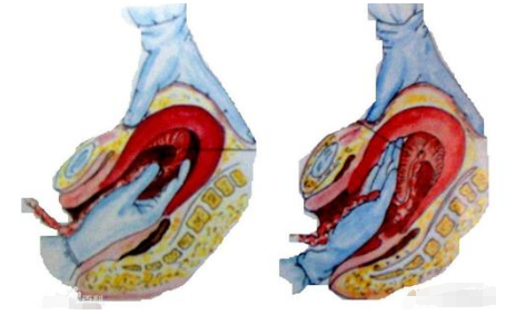 三张图解读分娩过程,看完心疼产妇