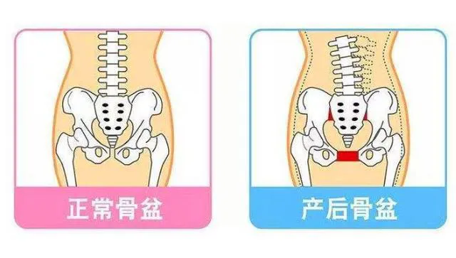 妈妈胯和少女胯的区别在哪里？看钟丽缇同框照，搞定你的臀部胖！