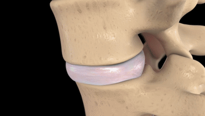 6个缓解腰椎间盘突出的伸展运动，避免7个训练，强壮腰椎不踩雷