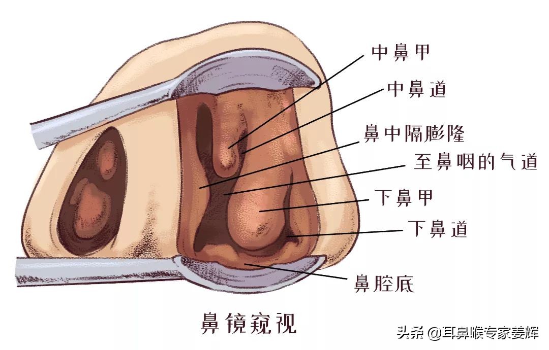 鼻炎拖着不治真的可以吗