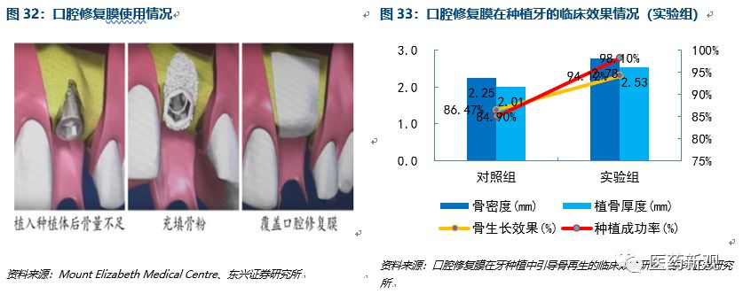 种植牙行业报告：核心技术国外垄断，每颗种植牙成本2000卖1万