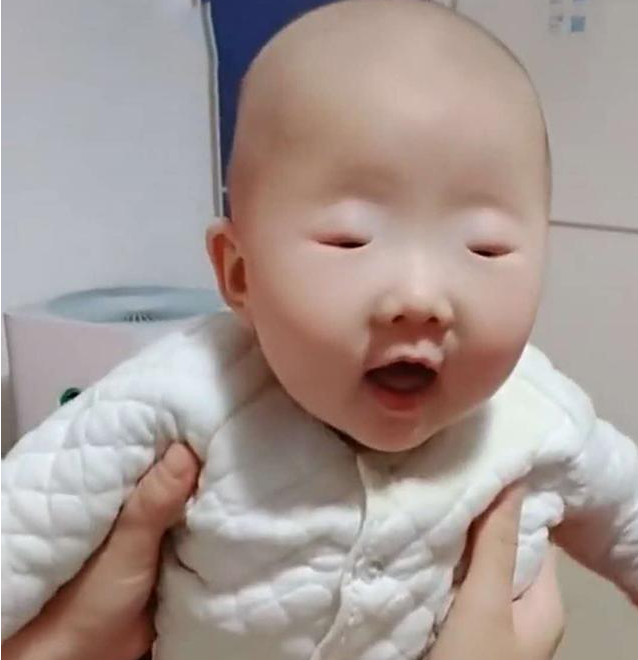 三个月宝宝眼睛过小,宝妈分不清眼睛是否睁开,医生的话太搞笑
