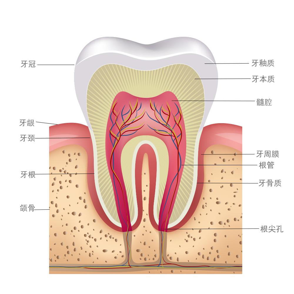 3,根管治疗后,患者的牙体已经失去了来自于牙髓的