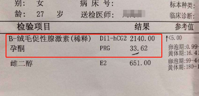 懷孕多久做b超檢查,太早沒意義,太晚又天天擔心,這個孕周剛好