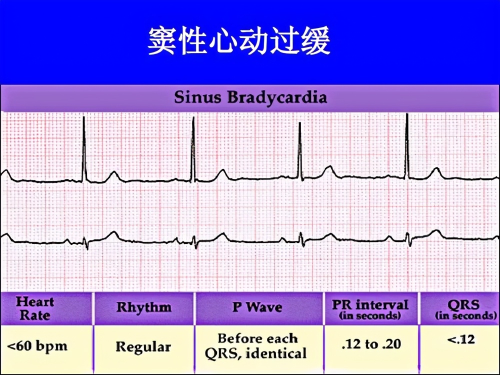 足球比赛突然倒地是为什么(欧洲杯晕倒球员埃里克森，最新病因分析！医生：此病可能性最大)