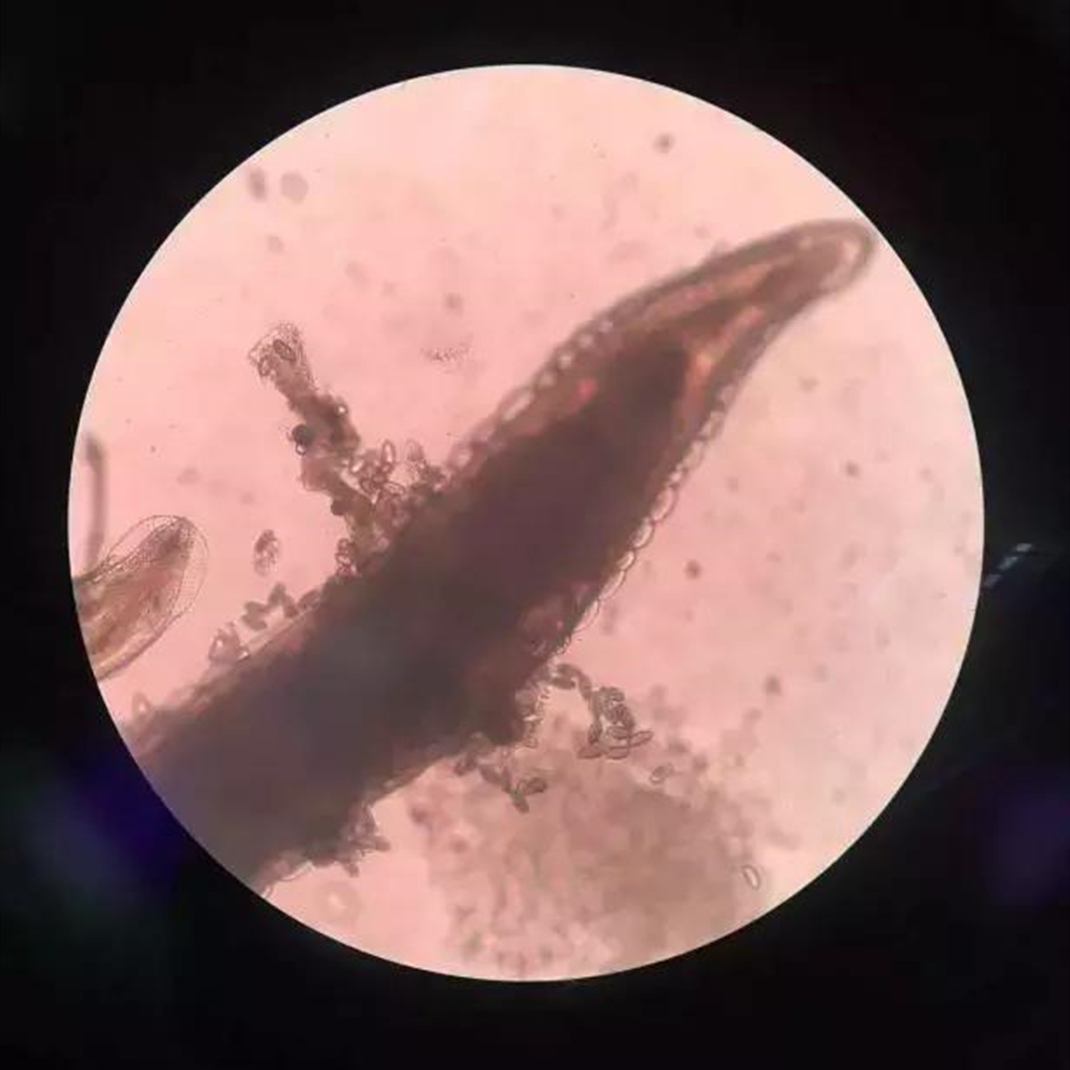 绕虫卵图片(宝宝边哭边抓) - 赤虎壹号