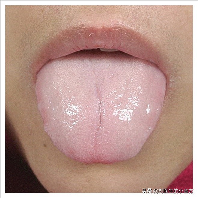 《中医舌诊》,9大体质舌诊图,看看你属于哪种?