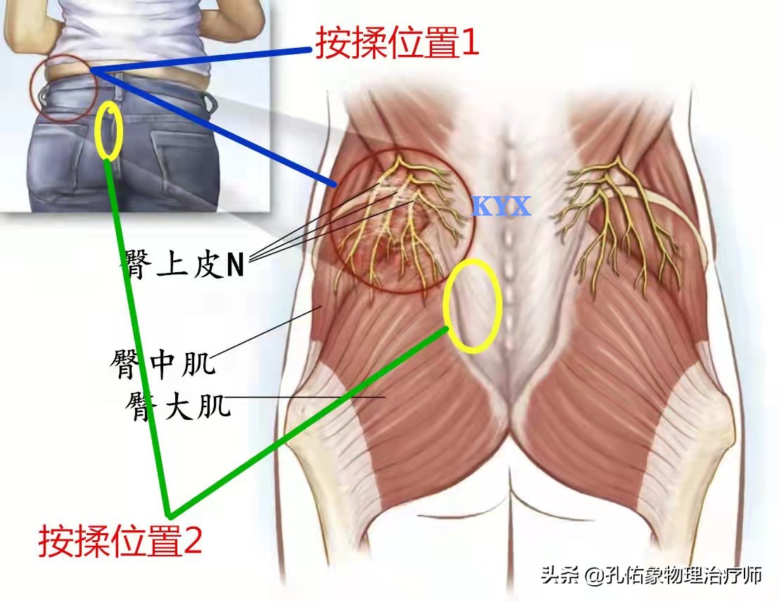 腰臀部疼或下肢麻木，是腰椎间盘突出吗？9种疾病需鉴别