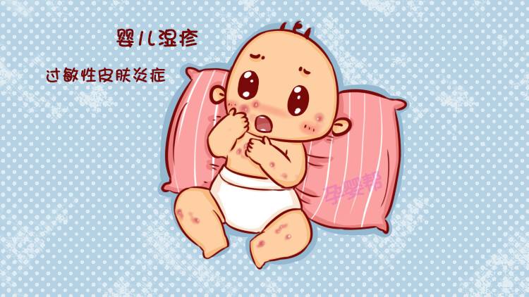过敏宝宝怕出汗，湿疹、热疹可怎么办？