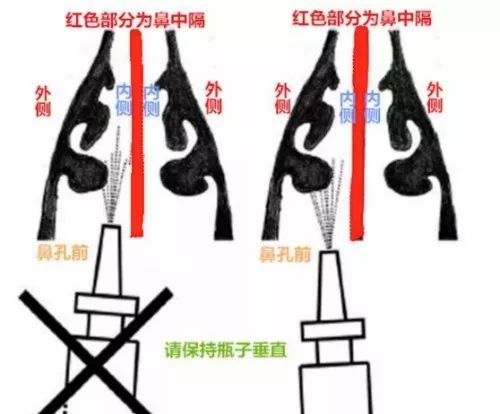 小S做的这个小手术，听说能治好鼻炎！靠谱吗？