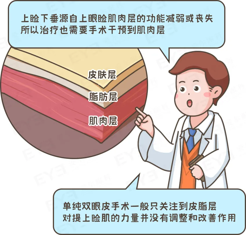 眼皮没力氣，不是“睡不醒”，而是“上睑下垂”这种病