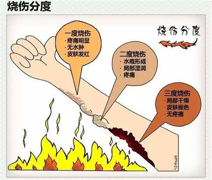 宝宝被烫伤怎么办？把握黄金120秒，儿科医生教您处理