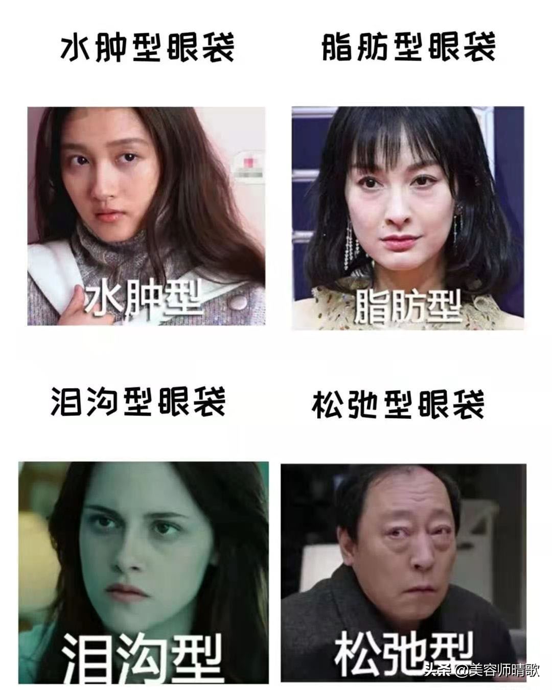 太好了！终于找到去眼袋的法子啦，5招去眼袋方法快收藏