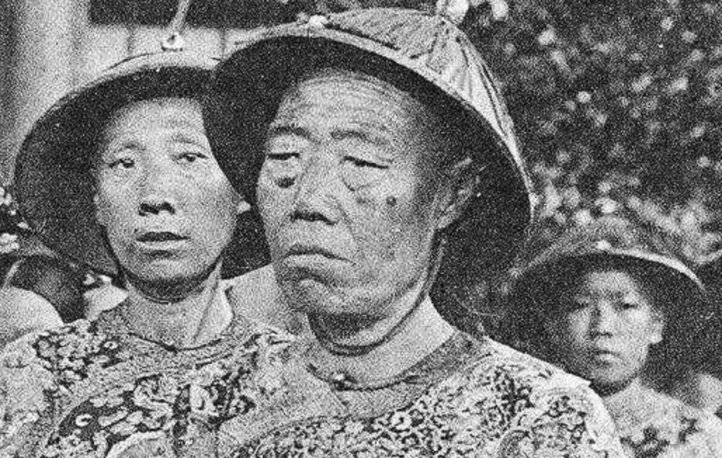 为了向朝廷交差,阮让又从民间买了一批儿童,阉割,结果,又阉死了一部分